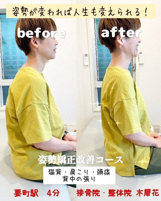 宗形テクニック 頸椎・胸椎部の痛みと肩こりの治療 頚椎ヘルニアと肩こり |